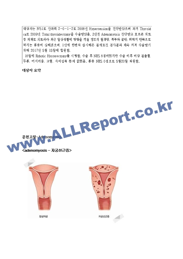 여성간호학실습 자궁근종 케이스 [간호진단 및 간호과정 4개]   (2 )